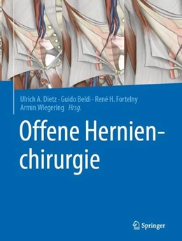 Abbildung von Dietz / Beldi | Offene Hernienchirurgie | 1. Auflage | 2021 | beck-shop.de