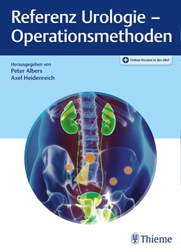 Abbildung von Albers / Heidenreich (Hrsg.) | Referenz Urologie - Operationsmethoden | 1. Auflage | 2022 | beck-shop.de