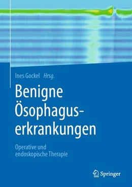 Abbildung von Gockel | Benigne Ösophaguserkrankungen | 1. Auflage | 2021 | beck-shop.de