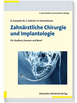 Abbildung von Gutwald / Schmelzeisen | Zahnärztliche Chirurgie und Implantologie 3. A. | 3. Auflage | 2018 | beck-shop.de