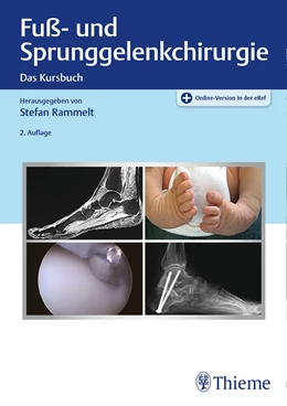 Abbildung von Rammelt | Fuß- und Sprunggelenkchirurgie | 2. Auflage | 2021 | beck-shop.de