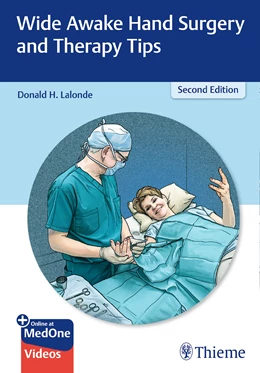 Abbildung von Lalonde | Wide Awake Hand Surgery and Therapy Tips | 2. Auflage | 2021 | beck-shop.de