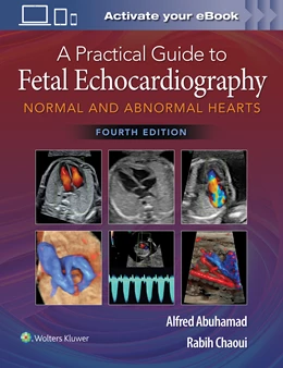 Abbildung von Abuhamad / Chaoui | A Practical Guide to Fetal Echocardiography | 4. Auflage | 2022 | beck-shop.de