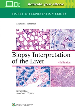 Abbildung von Torbenson | Biopsy Interpretation of the Liver | 4. Auflage | 2021 | beck-shop.de