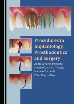 Abbildung von Pelegrine / Teixeira | Procedures in Implantology, Prosthodontics and Surgery | 1. Auflage | 2021 | beck-shop.de