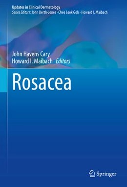 Abbildung von Cary / Maibach | Rosacea | 1. Auflage | 2020 | beck-shop.de
