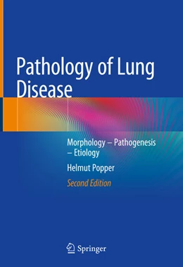 Abbildung von Popper | Pathology of Lung Disease | 2. Auflage | 2021 | beck-shop.de