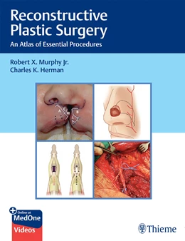 Abbildung von Murphy / Herman | Reconstructive Plastic Surgery | 1. Auflage | 2023 | beck-shop.de