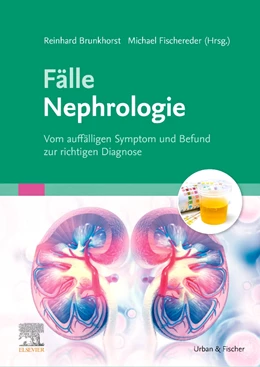 Abbildung von Brunkhorst / Fischereder | Fälle Nephrologie | 1. Auflage | 2021 | beck-shop.de