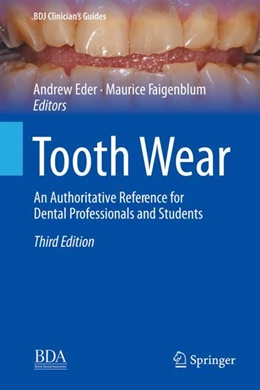 Abbildung von Eder / Faigenblum | Tooth Wear | 3. Auflage | 2022 | beck-shop.de