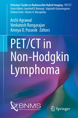 Abbildung von Agrawal / Rangarajan | PET/CT in Non-Hodgkin Lymphoma | 1. Auflage | 2021 | beck-shop.de