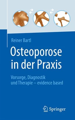 Abbildung von Bartl | Osteoporose in der Praxis | 1. Auflage | 2022 | beck-shop.de