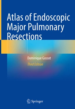 Abbildung von Gossot | Atlas of Endoscopic Major Pulmonary Resections | 3. Auflage | 2021 | beck-shop.de
