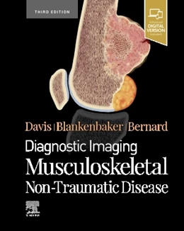Abbildung von Davis / Blankenbaker | Diagnostic Imaging: Musculoskeletal Non-Traumatic Disease | 3. Auflage | 2022 | beck-shop.de