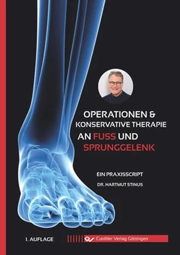 Abbildung von Stinus | Operationen & konservative Therapie an Fuß und Sprunggelenk | 1. Auflage | 2021 | beck-shop.de