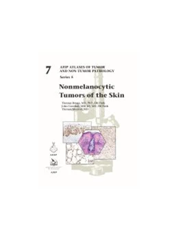 Abbildung von Nonmelanocytic Tumors of the Skin | 1. Auflage | 2021 | beck-shop.de