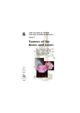 Abbildung von Tumors of the Bones and Joints | 1. Auflage | 2021 | beck-shop.de
