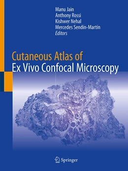 Abbildung von Jain / Rossi | Cutaneous Atlas of Ex Vivo Confocal Microscopy | 1. Auflage | 2022 | beck-shop.de