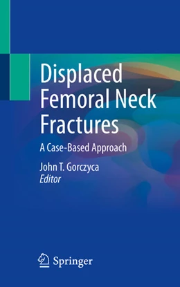 Abbildung von Gorczyca | Displaced Femoral Neck Fractures | 1. Auflage | 2021 | beck-shop.de