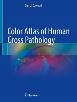 Abbildung von Dawood | Color Atlas of Human Gross Pathology | 1. Auflage | 2022 | beck-shop.de