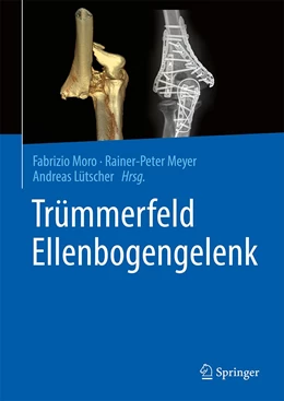 Abbildung von Moro / Meyer | Trümmerfeld Ellenbogengelenk | 1. Auflage | 2022 | beck-shop.de