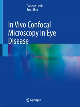 Abbildung von Latifi / Hau | In Vivo Confocal Microscopy in Eye Disease | 1. Auflage | 2022 | beck-shop.de