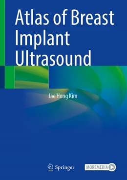 Abbildung von Kim | Atlas of Breast Implant Ultrasound | 1. Auflage | 2022 | beck-shop.de