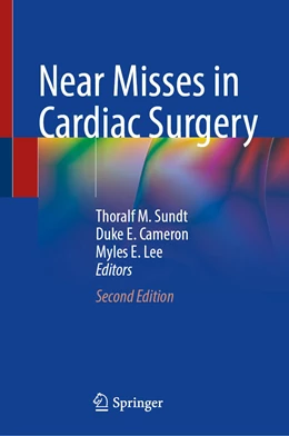 Abbildung von Sundt / Cameron | Near Misses in Cardiac Surgery | 2. Auflage | 2022 | beck-shop.de