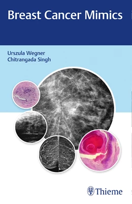 Abbildung von Wegner / Singh | Breast Cancer Mimics | 1. Auflage | 2021 | beck-shop.de