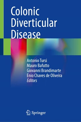 Abbildung von Tursi / Bafutto | Colonic Diverticular Disease | 1. Auflage | 2022 | beck-shop.de