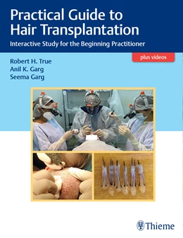 Abbildung von Practical Guide to Hair Transplantation - Interactive Study for the Beginning Practitioner | 1. Auflage | 2021 | beck-shop.de