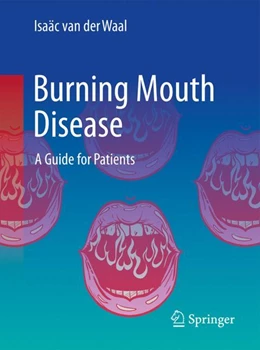 Abbildung von van der Waal | Burning Mouth Disease | 1. Auflage | 2022 | beck-shop.de