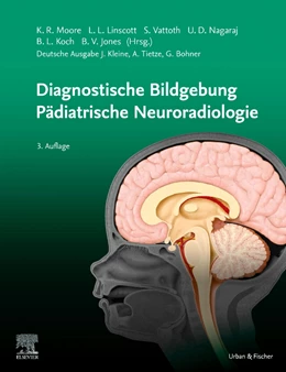 Abbildung von Moore | Diagnostische Bildgebung Pädiatrische Neuroradiologie | 3. Auflage | 2022 | beck-shop.de