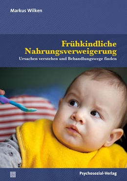 Abbildung von Wilken | Frühkindliche Nahrungsverweigerung | 1. Auflage | 2022 | beck-shop.de