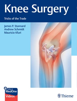 Abbildung von Stannard / Schmidt | Knee Surgery | 1. Auflage | 2022 | beck-shop.de
