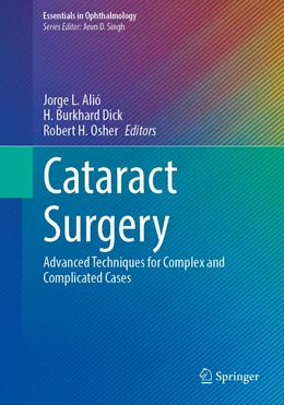 Abbildung von Alió / Dick | Cataract Surgery | 1. Auflage | 2022 | beck-shop.de