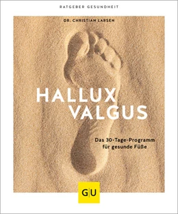 Abbildung von Larsen | Hallux valgus | 1. Auflage | 2022 | beck-shop.de