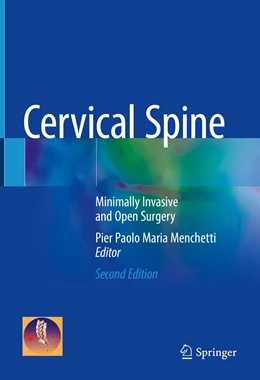 Abbildung von Menchetti | Cervical Spine | 2. Auflage | 2022 | beck-shop.de