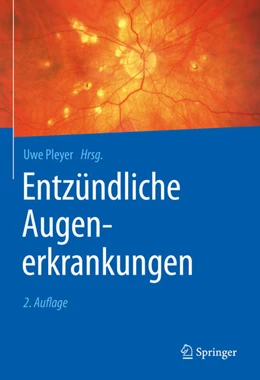 Abbildung von Pleyer | Entzündliche Augenerkrankungen | 2. Auflage | 2021 | beck-shop.de