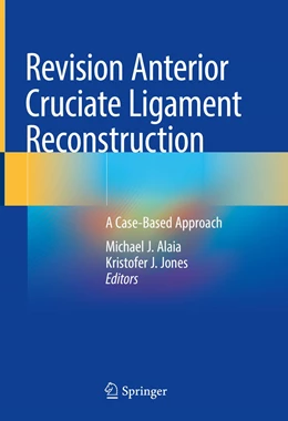 Abbildung von Alaia / Jones | Revision Anterior Cruciate Ligament Reconstruction | 1. Auflage | 2022 | beck-shop.de