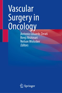 Abbildung von Zerati / Nishinari | Vascular Surgery in Oncology | 1. Auflage | 2022 | beck-shop.de