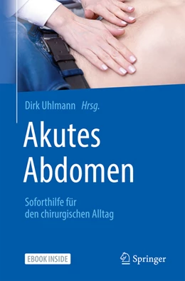 Abbildung von Uhlmann | Akutes Abdomen - Soforthilfe für den chirurgischen Alltag | 1. Auflage | 2022 | beck-shop.de