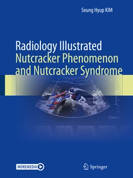 Abbildung von Kim | Radiology Illustrated: Nutcracker Phenomenon and Nutcracker Syndrome | 1. Auflage | 2022 | beck-shop.de
