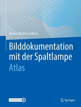 Abbildung von Gellrich | Bilddokumentation mit der Spaltlampe | 1. Auflage | 2023 | beck-shop.de