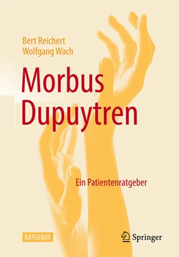 Abbildung von Reichert / Wach | Morbus Dupuytren | 1. Auflage | 2022 | beck-shop.de