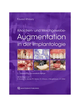 Abbildung von Khoury | Knochen- und Weichgewebeaugmentation in der Implantologie | 1. Auflage | 2024 | beck-shop.de