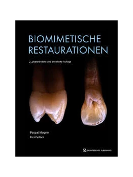 Abbildung von Magne / Belser | Biomimetische Restaurative Zahnheilkunde | 2. Auflage | 2023 | beck-shop.de