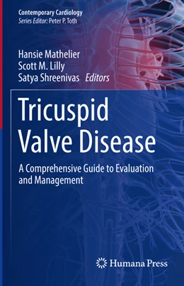 Abbildung von Mathelier / Lilly | Tricuspid Valve Disease | 1. Auflage | 2022 | beck-shop.de
