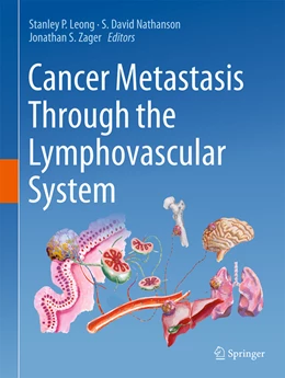 Abbildung von Leong / Nathanson | Cancer Metastasis Through the Lymphovascular System | 1. Auflage | 2022 | beck-shop.de