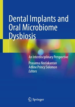 Abbildung von Neelakantan / Princy Solomon | Dental Implants and Oral Microbiome Dysbiosis | 1. Auflage | 2022 | beck-shop.de